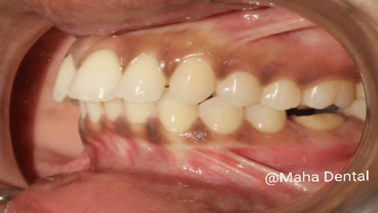 Maha Dental Centre in Banjara Hills,Hyderabad Best Dentists in Hyderabad Justdial